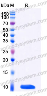 YHA47602, SDS-PAGE