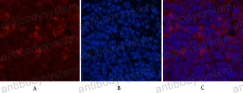 Валидация IF - AntibodySystem RHE04901