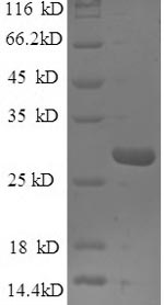 SDS-PAGE