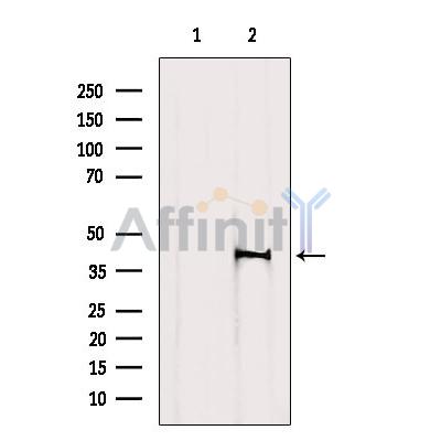 Валидация Affinity DF10263 - 5864