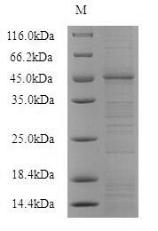 SDS-PAGE