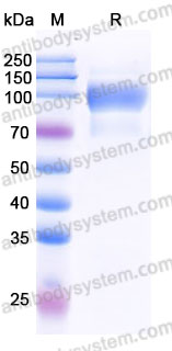 AHJ38902, SDS-PAGE