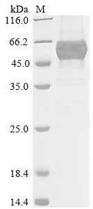 SDS-PAGE