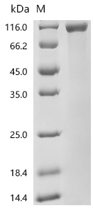 SDS-PAGE