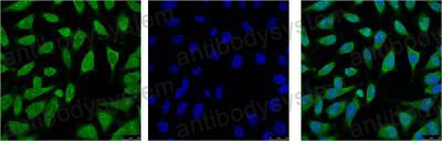 Валидация IF - AntibodySystem RHC69305