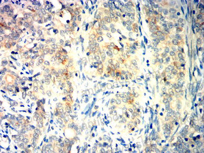 Валидация AntibodySystem RHJ28503