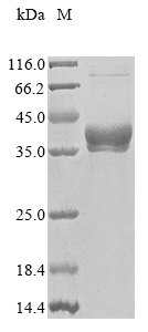 SDS-PAGE