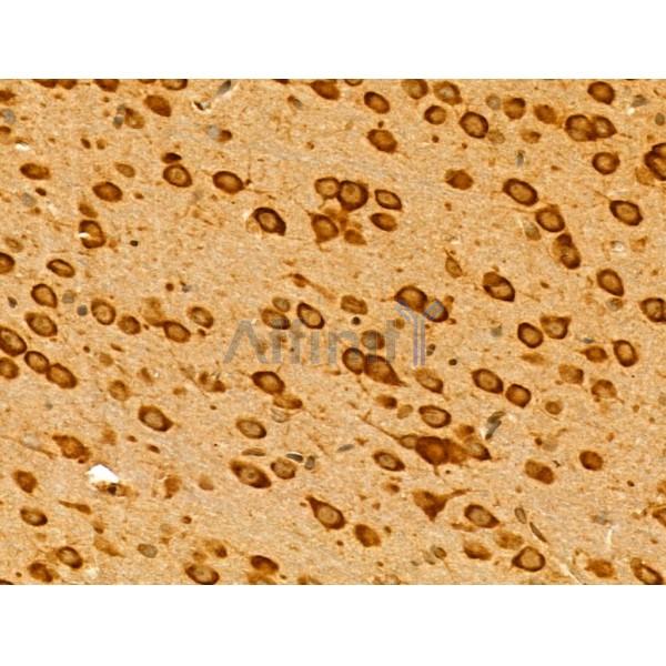 Валидация Affinity DF12204 - 6461