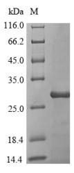 SDS-PAGE