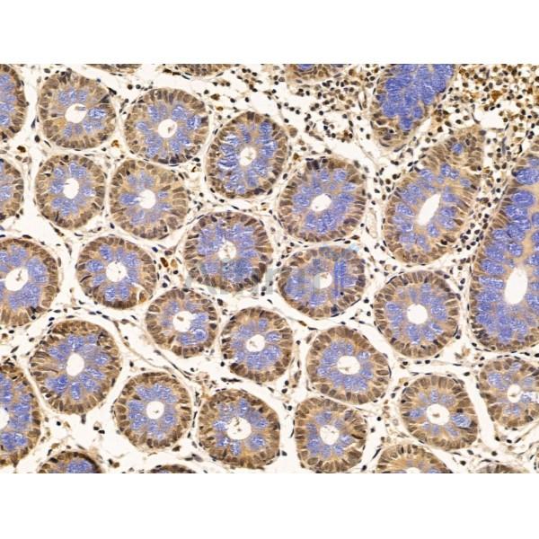 Валидация Affinity AF5447 - 3095