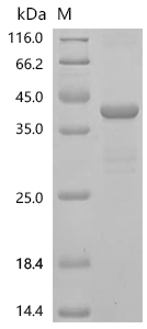 SDS-PAGE