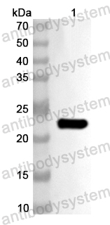 Валидация AntibodySystem PHA76701