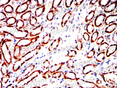 Валидация AntibodySystem RHC33503 (907)