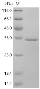 SDS-PAGE