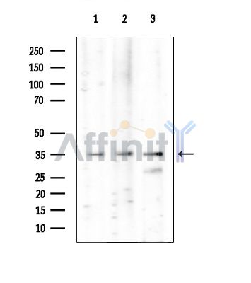Валидация Affinity DF14314 - 10207