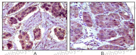 Валидация AntibodySystem RHB82405