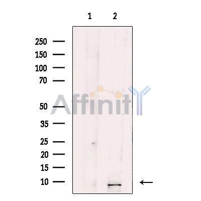 Валидация Affinity DF12136 - 6304