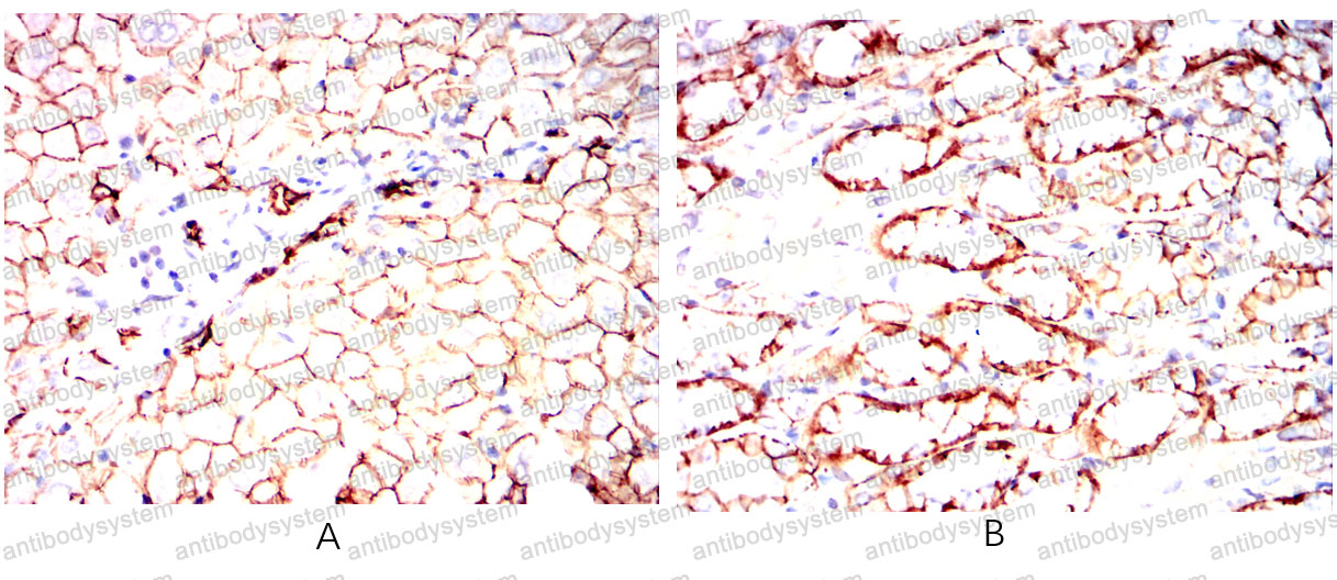 Валидация AntibodySystem RHD31902
