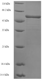SDS-PAGE