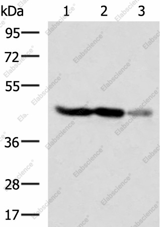 Вестерн-блоттинг, FDFT1, клетки HT29 и HepG2, ткань мозга плода человека