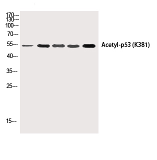 Валидация Elabscience E-AB-20287