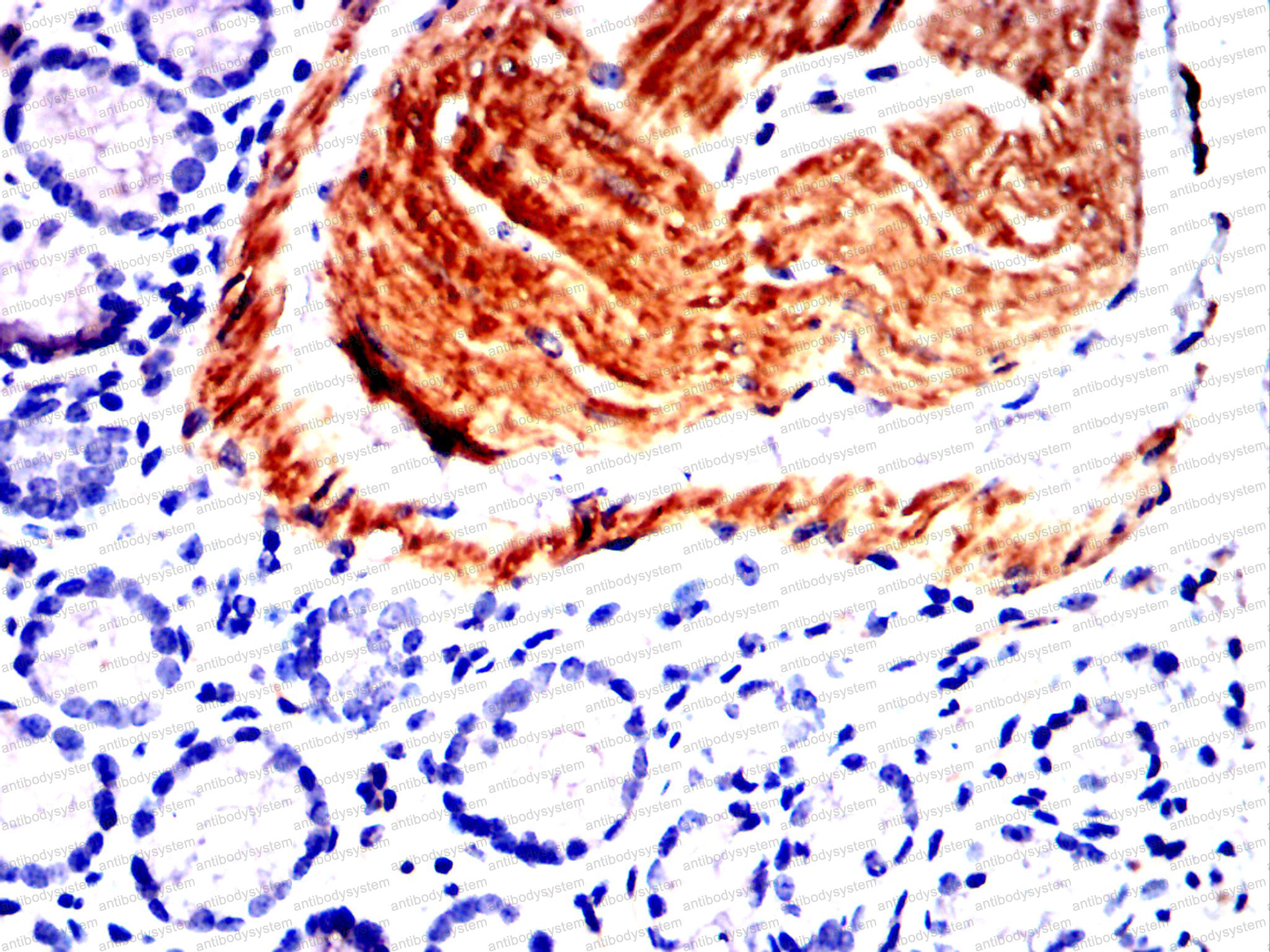 Валидация AntibodySystem RHF52709 (2551)