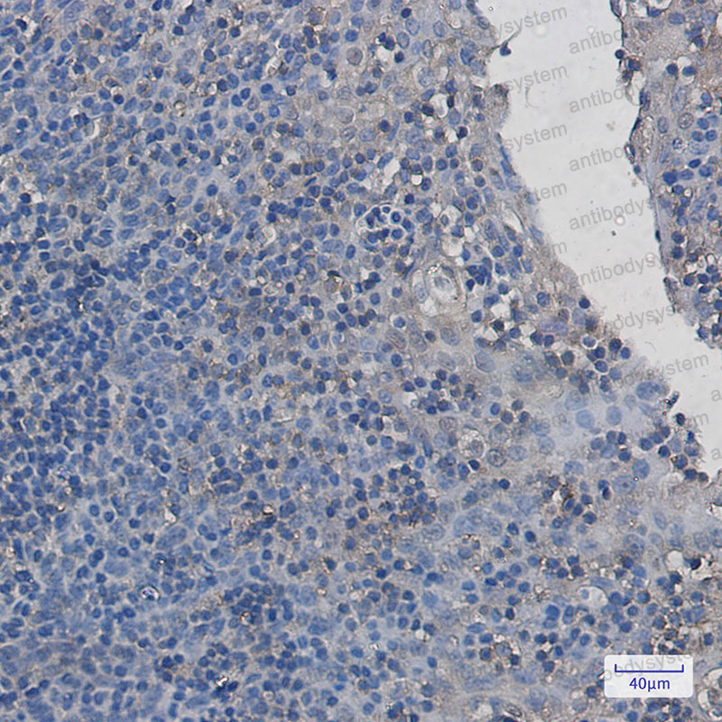 Валидация AntibodySystem RHG43201