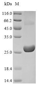 SDS-PAGE