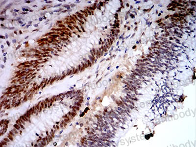 Валидация AntibodySystem RHA88904 (226)