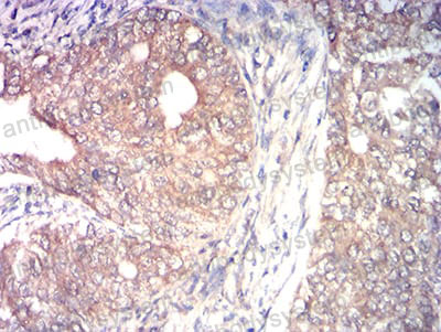 Валидация AntibodySystem RHN05602