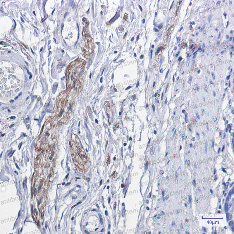 Валидация AntibodySystem RHD23206