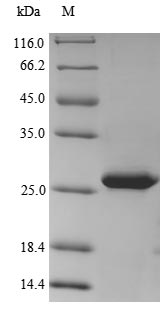 SDS-PAGE