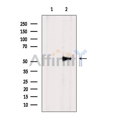 Валидация Affinity AF7013 - 4155