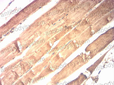 Валидация AntibodySystem RHC21101