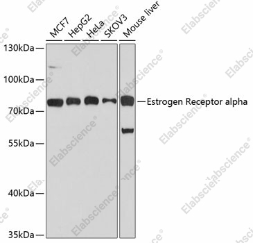Вестерн-блоттинг, Estrogen Receptor alpha, различные клеточные линии