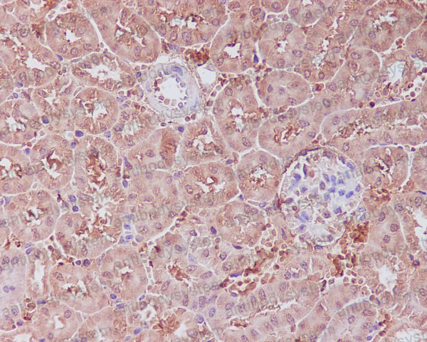 Валидация AntibodySystem RHA27801