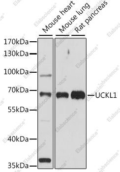 Вестерн-блоттинг, UCKL1, различные клеточные линии