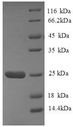 SDS-PAGE