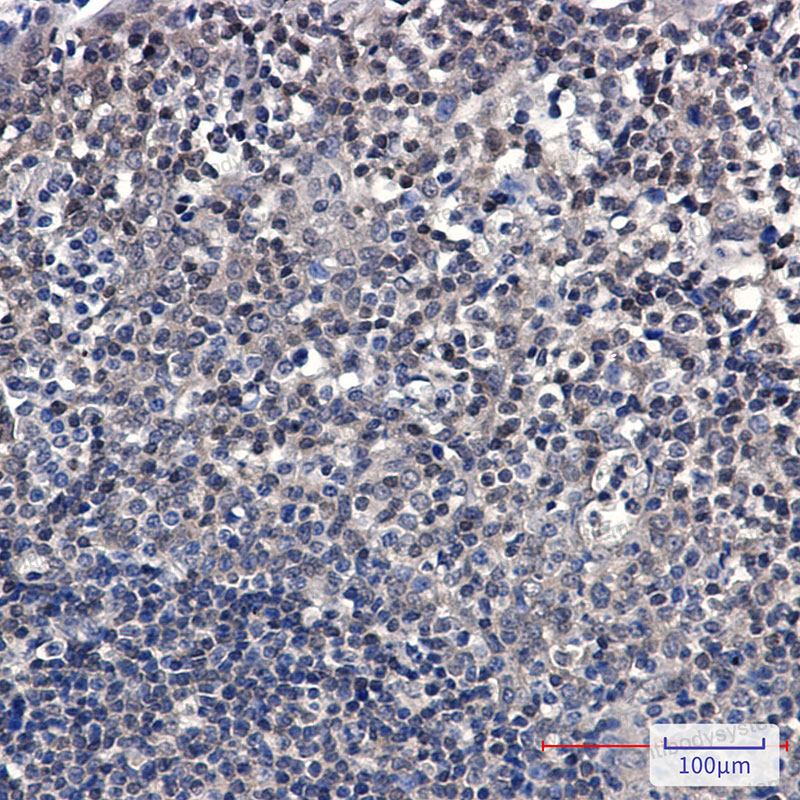 Валидация AntibodySystem RHF60801