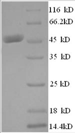 SDS-PAGE