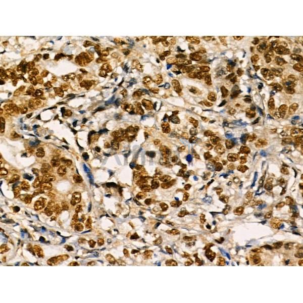 Валидация Affinity DF3122 - 13894