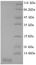 SDS-PAGE