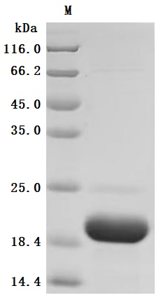 SDS-PAGE