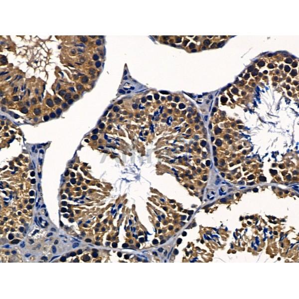 Валидация Affinity AF5158 - 2562