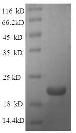 SDS-PAGE