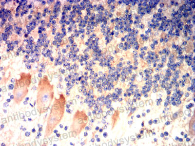 Валидация AntibodySystem RHD08208