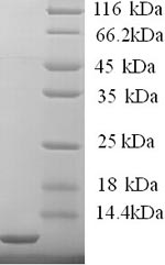 SDS-PAGE
