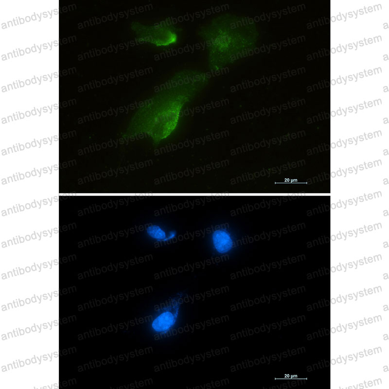 Валидация IF - AntibodySystem RHD22901