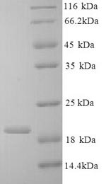 SDS-PAGE
