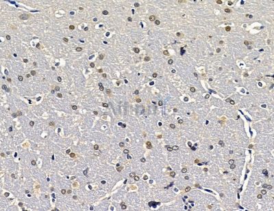 Валидация Affinity DF15372 - 11691